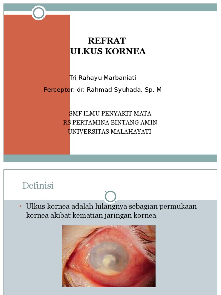 Ulkus Kornea