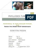 Phyllodes Tumor
