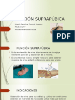 Punción Suprapúbica1