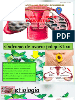 Ovario Poliquisticaa