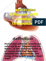Pericardial Effusion With Cardiac Temponade