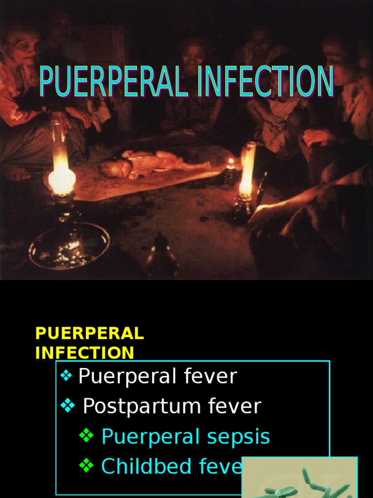 Puerperal Infection Management Guide | PDF | Childbirth | Vagina