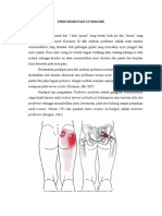 Piriformis Syndrome