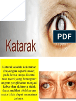 Penkes Katarak