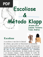 escoliose