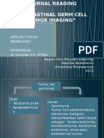 MEDIASTINAL TUMOR