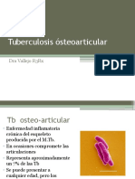 Tb osteo-articular: formas, síntomas y diagnóstico