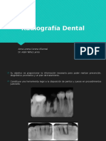 Radiografía en Endodoncia