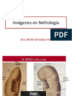 Imagenes en Nefrologia