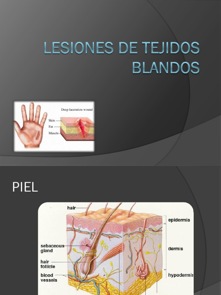 Lesiones de Tejidos Blandos PDF Herida Primeros auxilios