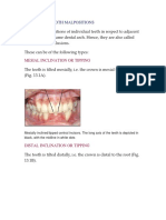 Individual Tooth Malpositions