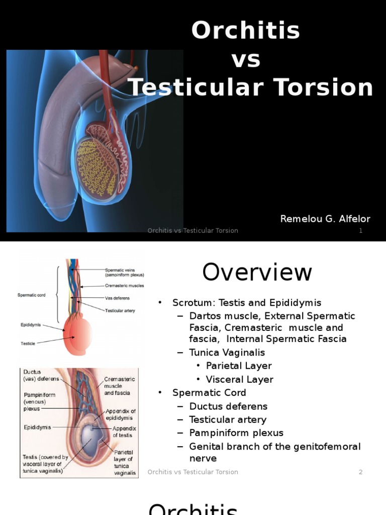 Orchitis vs Testicular Torsion Urology Report Medical Specialties
