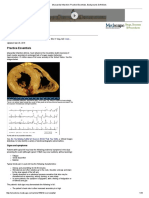 Myocardial Infarction - Practice Essentials, Background, Definitions