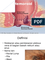 Hemoroid Bethesda