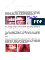 Leukemia Pembesaran Gingiva