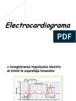 Ecg PDF