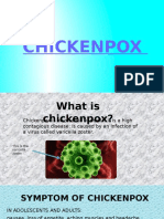 Chickenpox