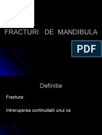 FRACTURI DE MANDIBULA Curs G