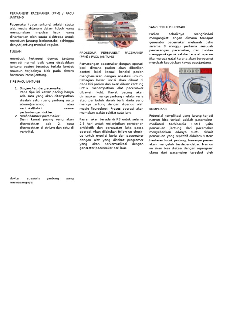 Pemasangan dan Perawatan PPM Jantung | PDF