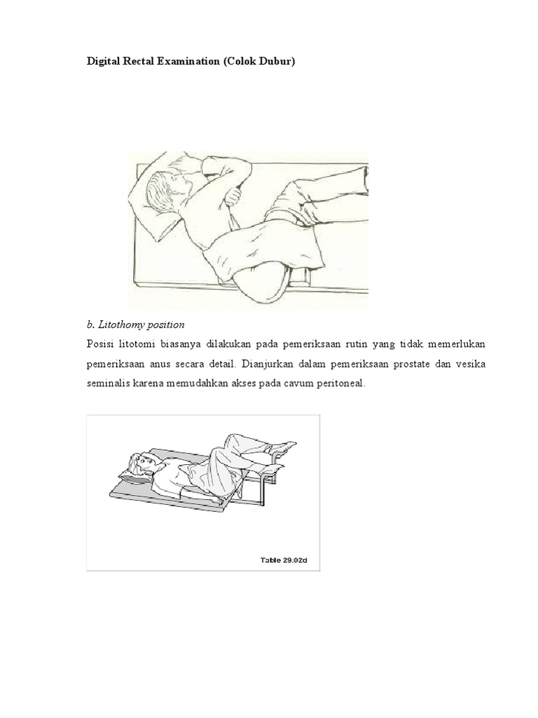 Digital Rectal Examination | PDF