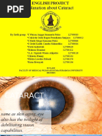 Cataract