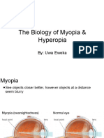 The Biology of Myopia & Hyperopia
