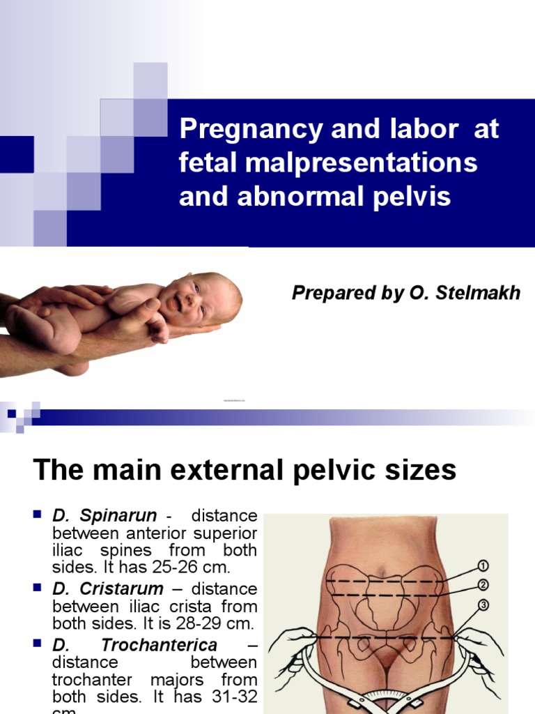 Obstetric Pelvic Measurements Guide | PDF | Pelvis | Childbirth