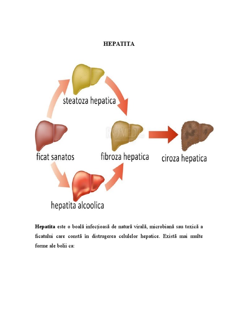 Hepatita