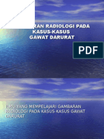 Gambaran Radiologi