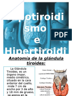 Hipotiroidismo 2