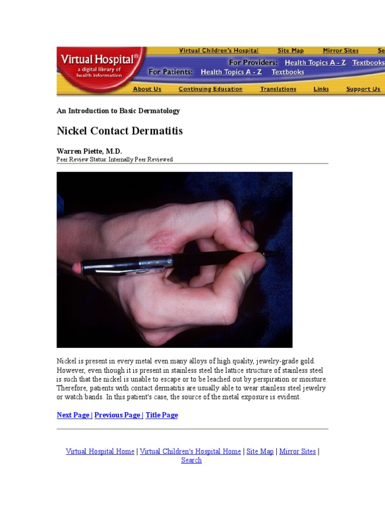 Nickel Contact Dermatitis An Introduction To Basic Dermatology PDF