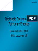 radiologic of pulmonary embolus.pdf
