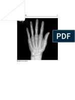 Radiology of The Hand