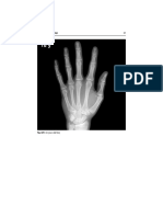 Radiology of Hand