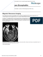 Imaging in Herpes Encephalitis - Overview, Computed Tomography, Magnetic Resonance Imaging 1