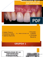 Radiologia de La Enfermedad Periodontal