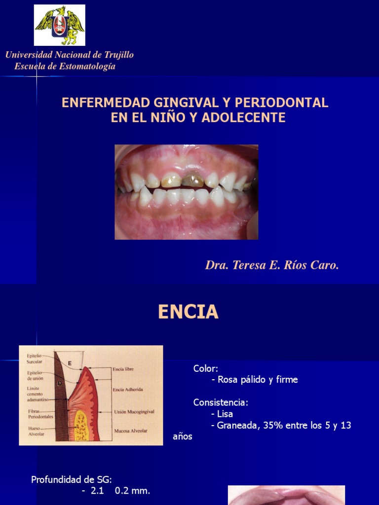 Gingivitis y Periodontitis en Niños y Adolecentes PDF Ciencias de