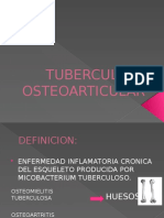 Tuberculosis Osteoarticular