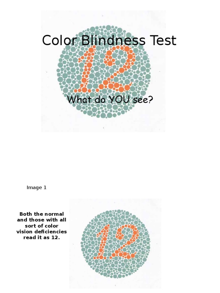 Color Blindess Test | PDF | Visual Perception | Color