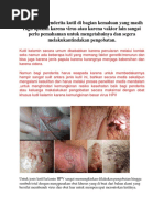 Download Gambar Kutil Kelamin Yang Berbahaya by Obat Kutil Pada Kelamin SN338276416 doc pdf