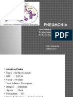 241562299-Ppt-Pneumonia-Radiologi.pptx