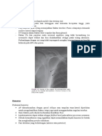 Referat Fraktur Radiologi