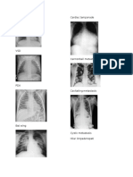 thorax 4