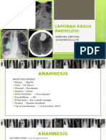 laporan Kasus Radiologi (foto lumbo-sacral) 
