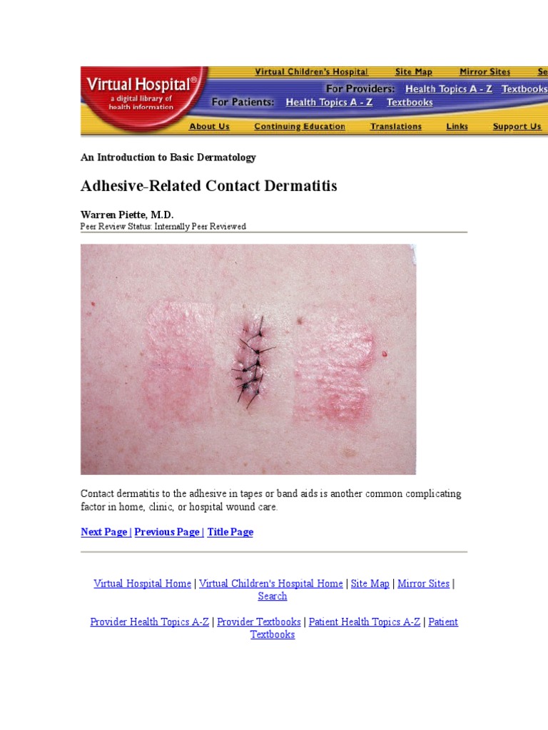 Adhesive Contact Dermatitis PDF