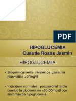 Hipoglucemia