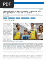 Protese de Mao Para Goleiro