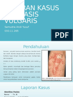 Laporan Kasus Psoriasis Vulgaris