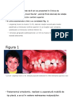 Caz Clinic 1 - Tudii