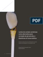 Artigo Lente Contato Rodrigo Souza - PDF.pdf